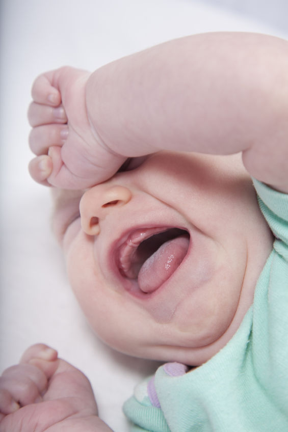 June 20: Tongue-tie in babies